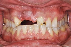multiple-dental-issues-before